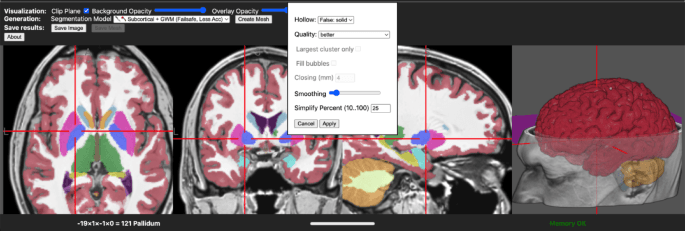 brain2print AI powered web tool for creating 3D printable brain models - Scientific Reports